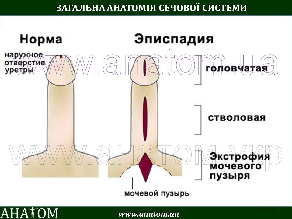 У меня на пенисе трещины чем и как их лечить У меня на пенисе трещины чем и как их лечить